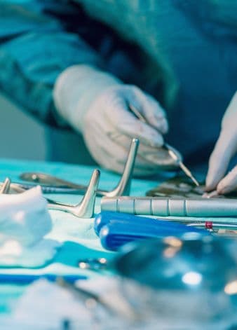 Doença periodontal em cães: o que é e por que dói